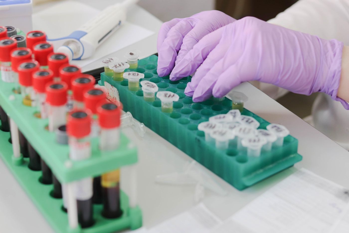 Mani con guanti viola manipolano provette in laboratorio di ricerca, simbolo del vaccino mRNA sperimentale