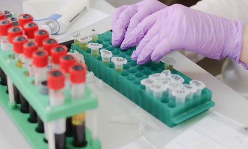 Mani con guanti viola manipolano provette in laboratorio di ricerca, simbolo del vaccino mRNA sperimentale