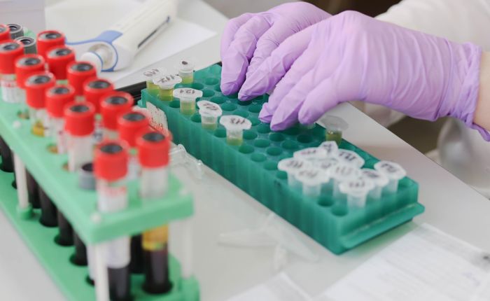 Mani con guanti viola manipolano provette in laboratorio di ricerca, simbolo del vaccino mRNA sperimentale